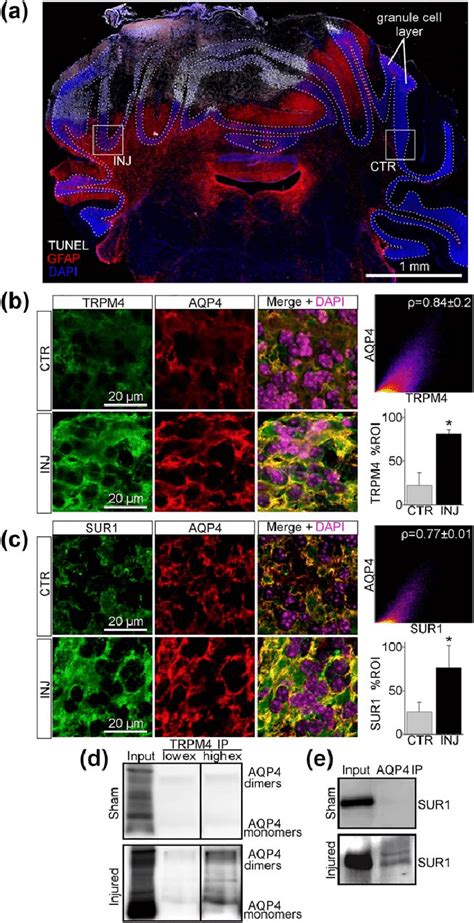 FIG URE 7 De Novo Expression Of The SUR1 TRPM4 AQP4 Complex In Granule