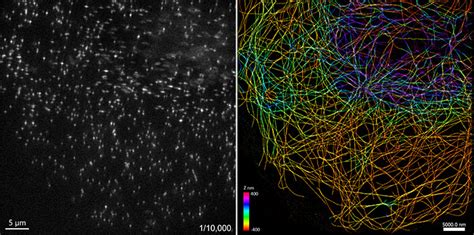 Overview Of Single Molecule Localization Microscopy Smlm Oxford