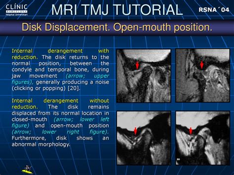 Rsna´04 Browsing Area Click To Links Below If You Want To Directly Go