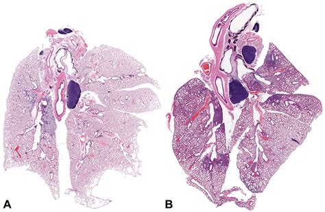 Mouse Lung Histology