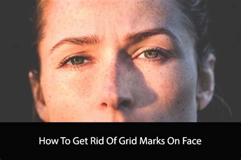 How To Get Rid Of Grid Marks On Face Expert Tips