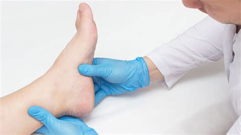 Shockwave Therapy For Plantar Fasciitis ️