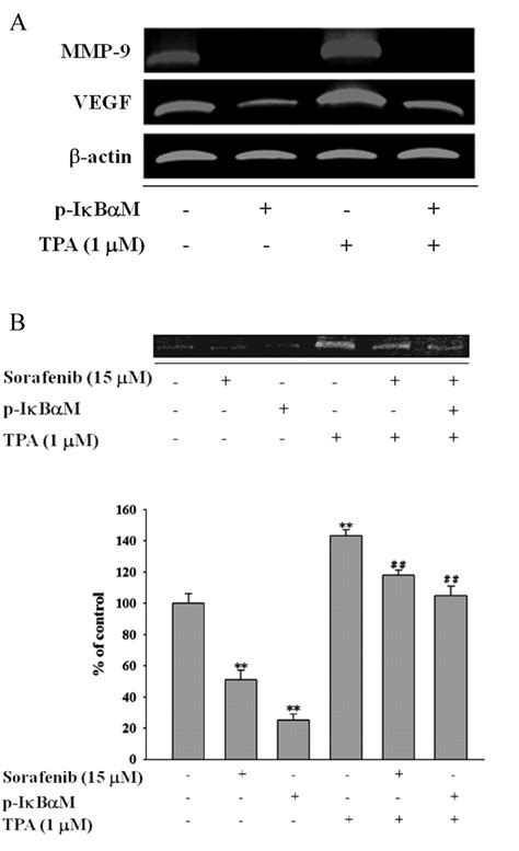 Sorafenib Inhibits Tpa Induced Mmp 9 And Vegf Expression Via