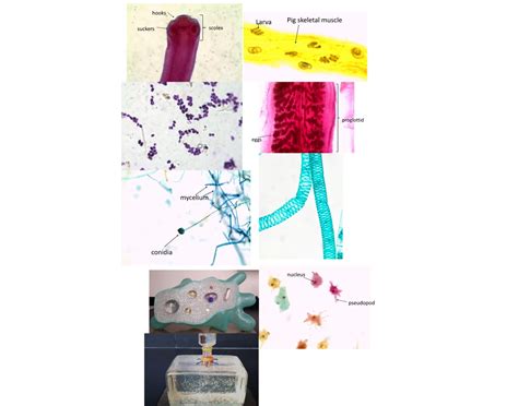 microbial diversity Quiz