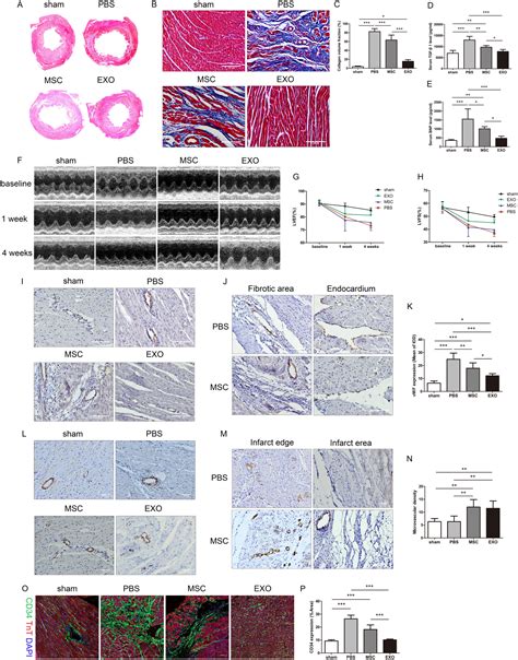 Cardiac Microvascular Functions Improved By Msc Derived Exosomes