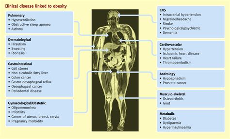 Medical Consequences Of Obesity Medicine