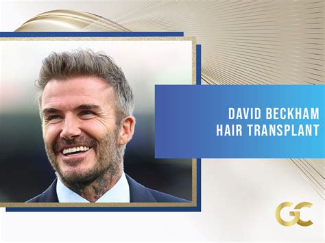 David Beckham Hair Transplant - Gold City Best Hair Transplant Turkey