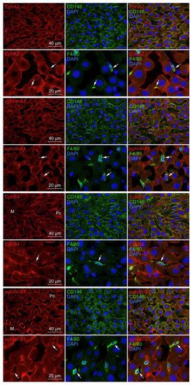 Biomedicines Special Issue Macrophages In Health And Non Infectious