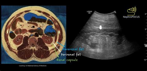 The ‘double Line Sign Nephropocus