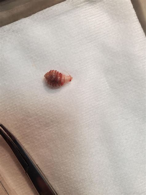 Is this a botfly larvae? : r/whatisthisbug