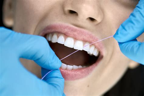 Importancia De Uso Del Hilo Dental Somos Dent