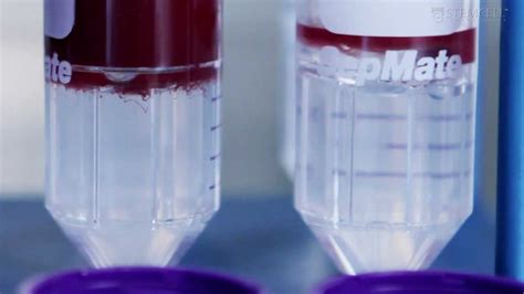 How To Use Sepmate To Isolate Pbmcs From Whole Blood In Just