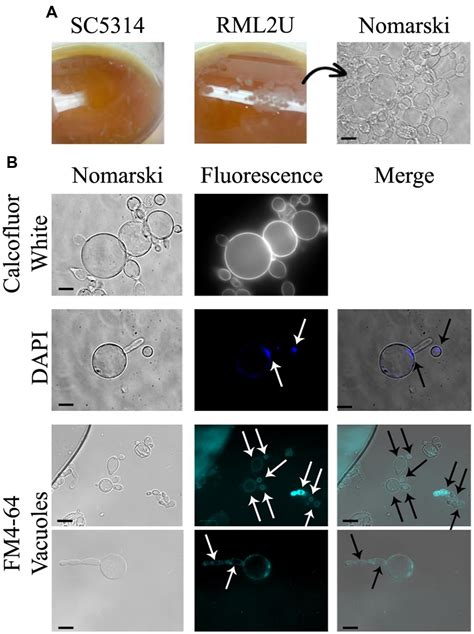 Frontiers The Cell Wall Protein Ecm33 Of Candida Albicans Is Involved In Chronological Life