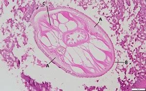 Dirofilaria Immitis Morphology