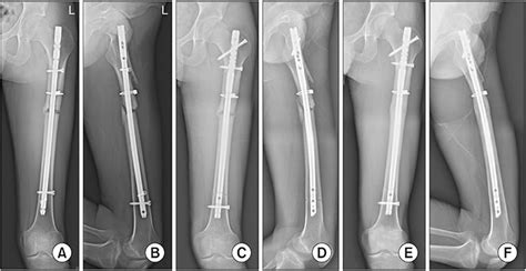 CIOS Clinics In Orthopedic Surgery