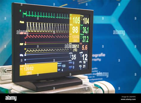 Monitoring Of Patient S Condition And Vital Signs With A Monitor In