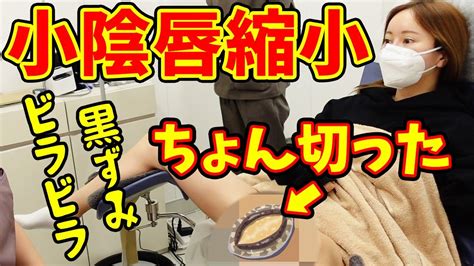 【小陰唇縮小】女性器のビラビラ・黒ずみを切って人生確変【モティーフ銀座クリニック】 Youtube