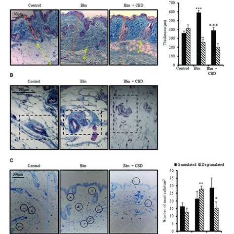 Cbd Reduces Liver Fibrosis Induced By Ccl4 A Representative Images