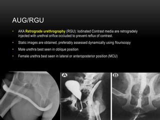 Ascending Urethrogram Ppt