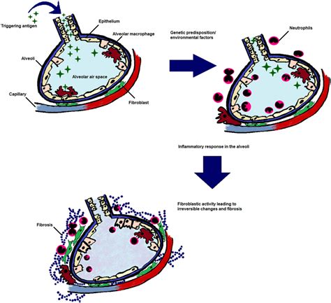 Proposed Mechanisms In The Pathogenesis Of Hypersensitivity