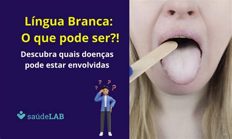 L Ngua Branca O Que Pode Ser Confira Causas Comuns Para Acender O