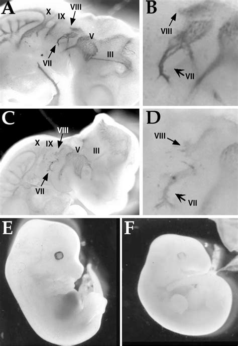 Cranial Nerve Development Semantic Scholar