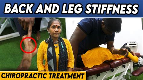 Back And Leg Stiffness Dr Vijay Non Surgical Chiropractic Treatment Youtube