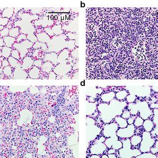 Sections Of Lung Tissue Hematoxylin And Eosin Staining 400 Total