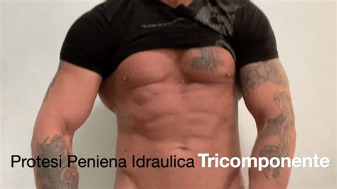 Protesi Peniena Idraulica Tricomponente Penile Implant Channel