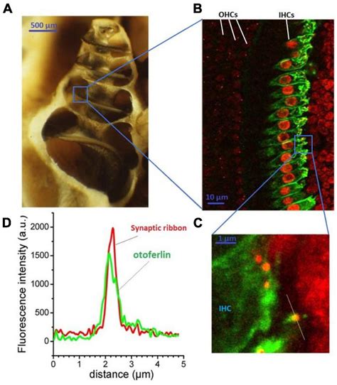 Frontiers Otoferlin As A Multirole Ca2 Signaling Protein From Inner