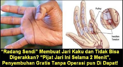 Kenapa Jari Tangan Sakit Homecare24