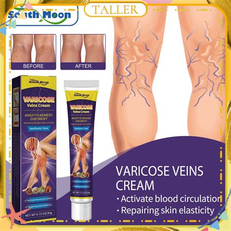 Ready Stcok South Moon Varicose Vein Cream Repairs Blood Vessels