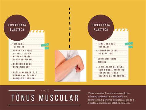 Hipertonia Fisioterapia Neurofuncional