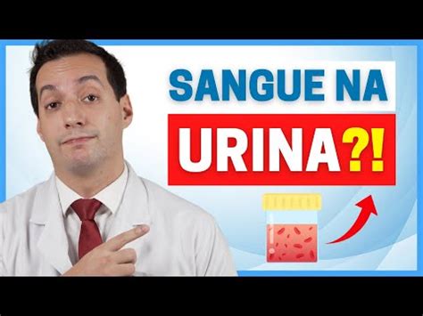 5 causas de hemácias na urina e como tratar