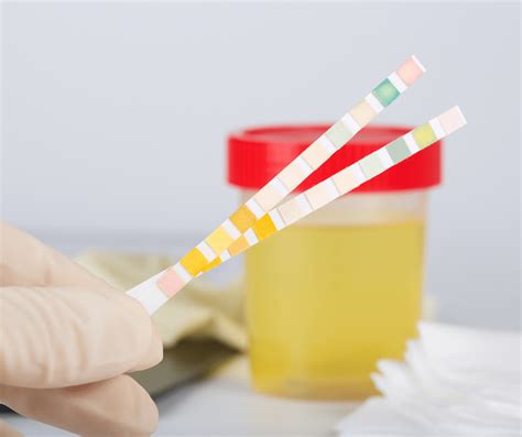 What Causes False Negative Drug Test Cares Healthy