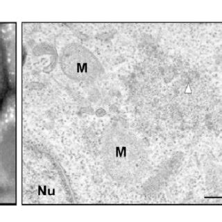 Ultrastructure Of Arsenite Induced Stress Granules In Human Cells Hela