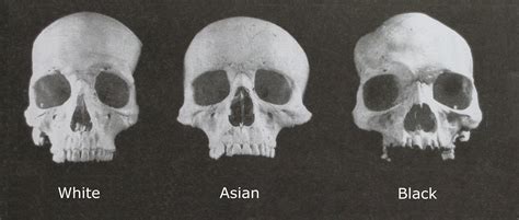 Facial Structures Of Different Races Telegraph