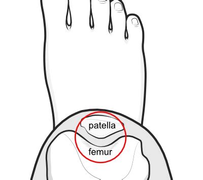 Patellofemoral joint | KNEEguru