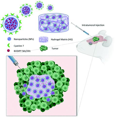 Intratumoral Injection Of Hydrogel Embedded Nanoparticles Enhances