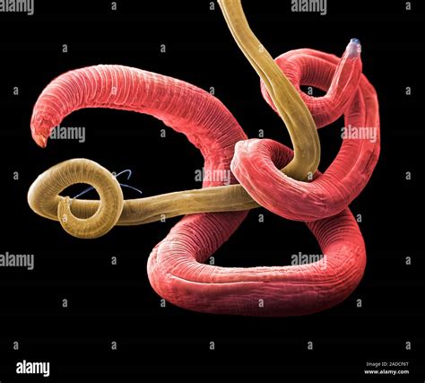 Coloured Scanning Electron Micrograph Sem Of A Female And Male Roundworm Contracaecum