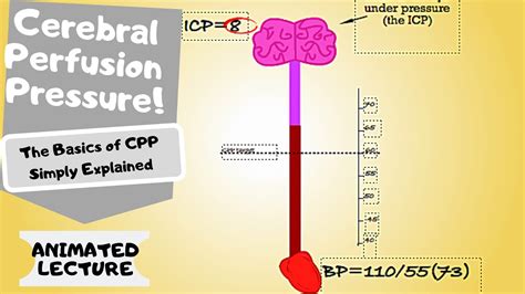 Cerebral Perfusion Pressure Cpp Made Easy Youtube