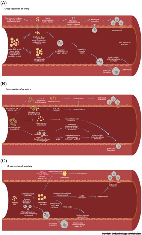 Lipids And Lipoproteins In Cardiovascular Diseases A Classification