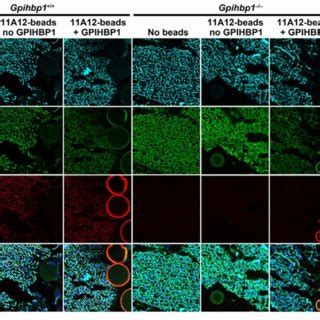 Movement Of LPL In The Interstitial Spaces Of Brown Adipose Tissue In A