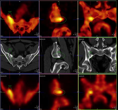 Signature Of Small Spatio Temporal Inconsistency Revealed By The