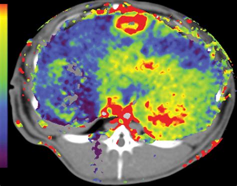 CT Color Mapping Of The Arterial Enhancement Fraction Of VX2 Carcinoma