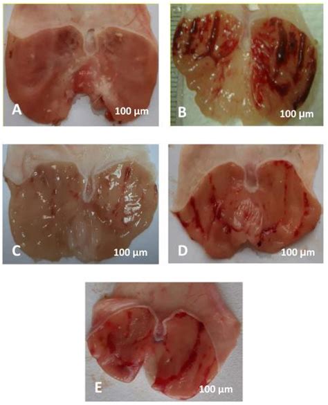 Gastric Ulcer Gu Model Creative Bioarray