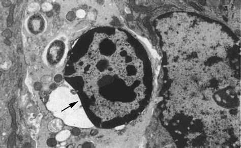 A Model Of Shigella Exneri Penetration Of The Intestinal Epithelium