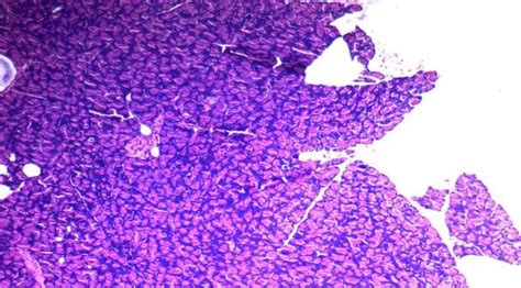 Histopathological Features Of Rat Pancreatic Cells Section From