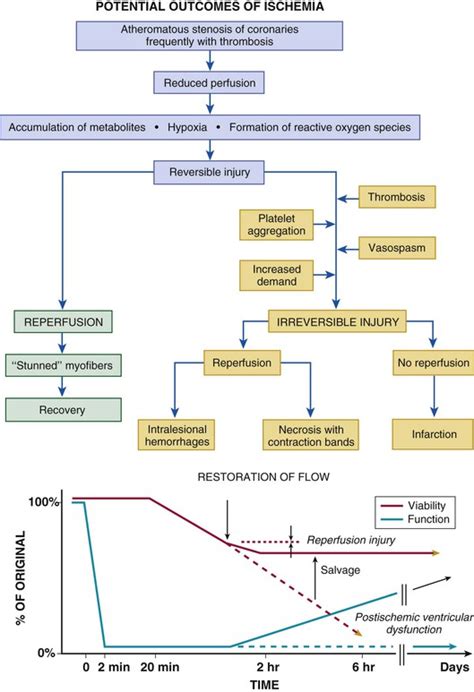 Acute Myocardial Infarction Pathophysiology