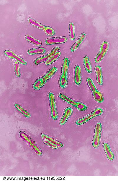 Botulinus Clostridium Botulinum This Bacterium Secretes A Toxin